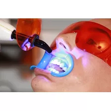 Blanqueamiento Dental Led + Limpieza Dental + Fluor Belgrano