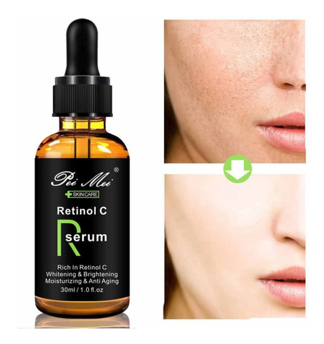 Retinol C Serum , Reduce Manchas E Hidratante Facial
