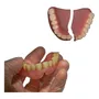Segunda imagen para búsqueda de dentaduras protesis dentales completas fijas