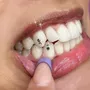 Primera imagen para búsqueda de strass para dientes