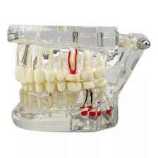 Manequim Dentista Modelo Odontológico Implantes Próteses Ort