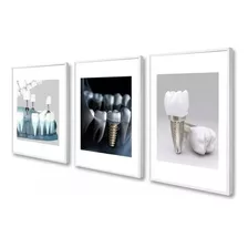 Kit 3 Quadros Decorativos Odontologia Implante Dentista Sala