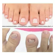 Manicure E Pedicure/vendas