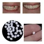 Terceira imagem para pesquisa de resina dental