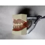 Primera imagen para búsqueda de tipodonto dental