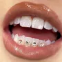 Tercera imagen para búsqueda de strass para dientes