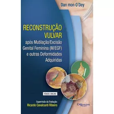 Reconstrucao Vulvar Com Video, De Dan Mon Dey O´dey. Editora Dilivros, Capa Dura, Edição 1ª Edição Em Português, 2020