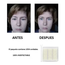 Tapes Para Tratar Ptosis Palpebral Levantar Parpados Caidos 