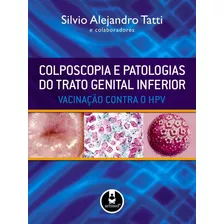 Livro Colposcopia E Patologias Do Trato Genital Inferior