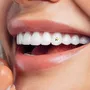 Tercera imagen para búsqueda de gemas dentales