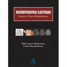 Neuropediatria Ilustrada: Imagens Clínico-radiológicas, De Montenegro, Maria Augusta. Editora Thieme Revinter Publicações Ltda, Capa Dura Em Português, 2015