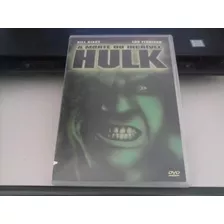 Dvd A Morte Do Incrível Hulk Bill Bixby Lou Ferrigno Raro