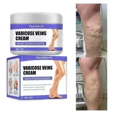 Creme Para Diminuir As Varizes,vasinhos,varicose Alivio Dor