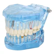 Manequim Modelo Dentário Odonto Boca Inteira Dente Dentista.