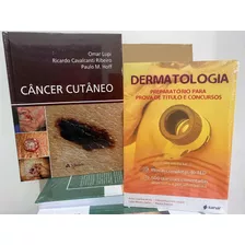 Dermatologia Preparatório Para Prova De Título + Câncer