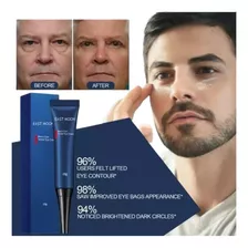 Crema Ojos Para Hombre Combate Líneas Finas Ojeras Blanquea