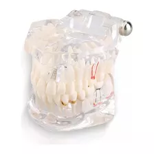 Modelo Dentário: Dentista De Dentes De Boca Cheia.