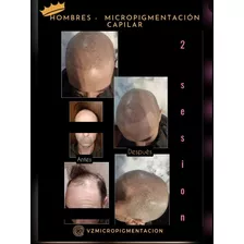 Micro Capilar Microblading