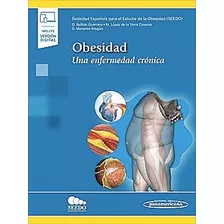 Obesidad Una Enfermedad Crónica - Seedo - Novedad