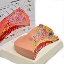 Glándula Mamaria Patologias Comunes - Modelos Anatomicos 