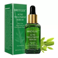 Serum Tratamiento Para Acne Pieles Grasas 100% Efectividad