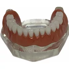 Manequim Modelo Odontológico Prótese Total Inf. P/ Dentistas