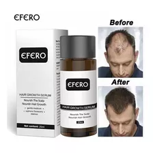 Tratamento Efero Calvície Queda De Cabelo Tônico Original