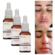 Kit Melasma Manchas Escuras Na Pele Rosto Face 3 Séruns Sh