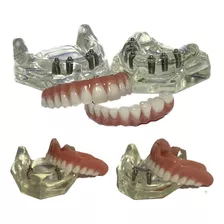 Manequins Modelos Odontológicos P/ Dentistas Kit C/ 4