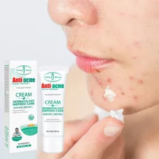 Crema Para Eliminar El Acné, Gel Antimanchas Aichun Beauty