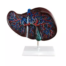 Modelo Anatômico Do Fígado Humano 