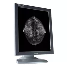 Monitor Barco 5 Mp Grado Médico Para Mamografía 