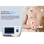 Segunda imagen para búsqueda de electrocardiografo monitor electrocardiograma ecg portatil