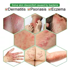 Crema Dermatitis Psoriasis - mL a $2000