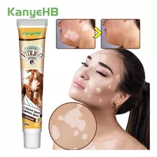 Crema Vitiligo Reducir Manchas Blancas Kanyehb 2 Pzas