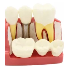 Modelo Didáctico Dental