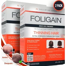 Trioxidil 10% Regeneración Capilar Total Super Pack 2 Meses