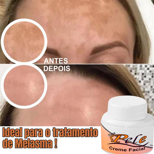 Imagens carrossel {'link': 'https://http2.mlstatic.com/D_785980-MLB54896898824_042023-O.jpg'}