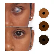  Lentes De Contacto Protésicos Disimula Defectos Oculares