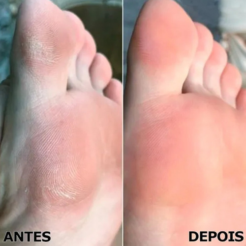 Imagens carrossel {'link': 'https://http2.mlstatic.com/D_791174-MLB53949486819_022023-O.jpg'}
