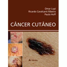 Câncer Cutâneo, De Lupi, Omar. Editora Atheneu Ltda, Capa Dura Em Português, 2018