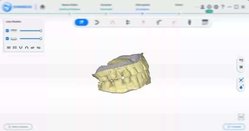 Digitalización De Modelos Dentales