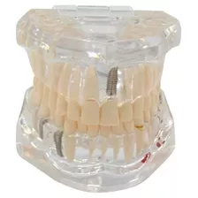 Dente Peca Acrilico Consultorio Modelo Estudo Odontologia