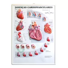 Pôster 3d De Doenças Cardiovasculares Em Alto-relevo