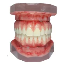 Macro Modelo E Protocolo Superior De Implantes