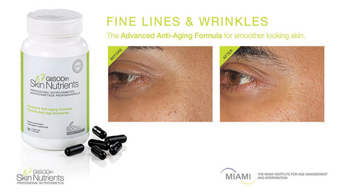 StriVectin Anti-Wrinkle SD Advanced Plus koncentrált ránctalanító krém 118 ml