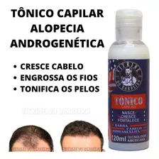 Tônico Fortacele E Nasce Cabelo Baraba E Sobrancelha.