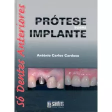 Prótese Sobre Implante - Só Dentes Anteriores, De Cardoso. Livraria Santos Editora Comércio E Importação Ltda., Capa Dura Em Português, 2008