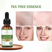 Serum Facial Té Verde Anti Acné Remueve Manchas 30ml Tipo De Piel Mixta