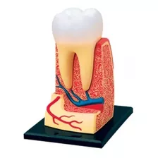 Dente Molar Cárie Anatomia Boca Estudo Ampliado Anatômico